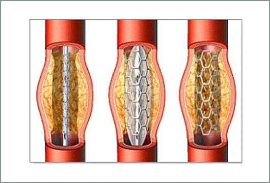 diavitiki-aggeiaki-3