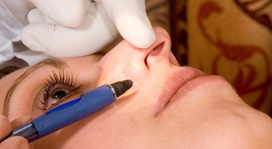 961158treatment1